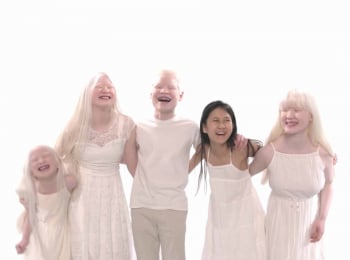 программа TLC: Люди альбиносы Знакомство с Грабовски